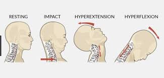 Exploring the Causes and Prevention of T-Bone Accidents